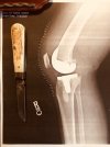 Knee Pic.jpeg