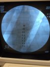 my spine.jpg