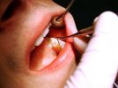 Sickle use 2 Scaling by Dental Hygienist.jpg