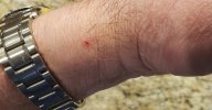 Wrist.jpg