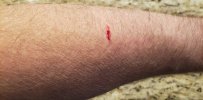 Arm.jpg