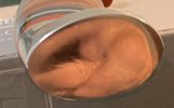 Case7.jpg Case7.jpg