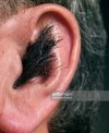 ear-hair-removal-methods-home-natural.jpg