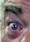 The_eye.JPG
