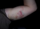 100_1622.JPG