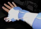 splint.jpg