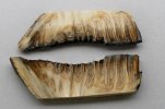 tooth root.jpg