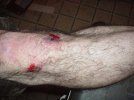shreddedknee 002.jpg