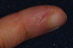 finger.jpg