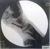 screwed hand1.jpg