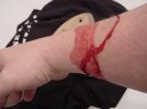 cut arm.jpg