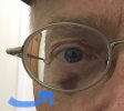 gt.blackeye.9.18.jpg