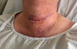 Incision.jpg