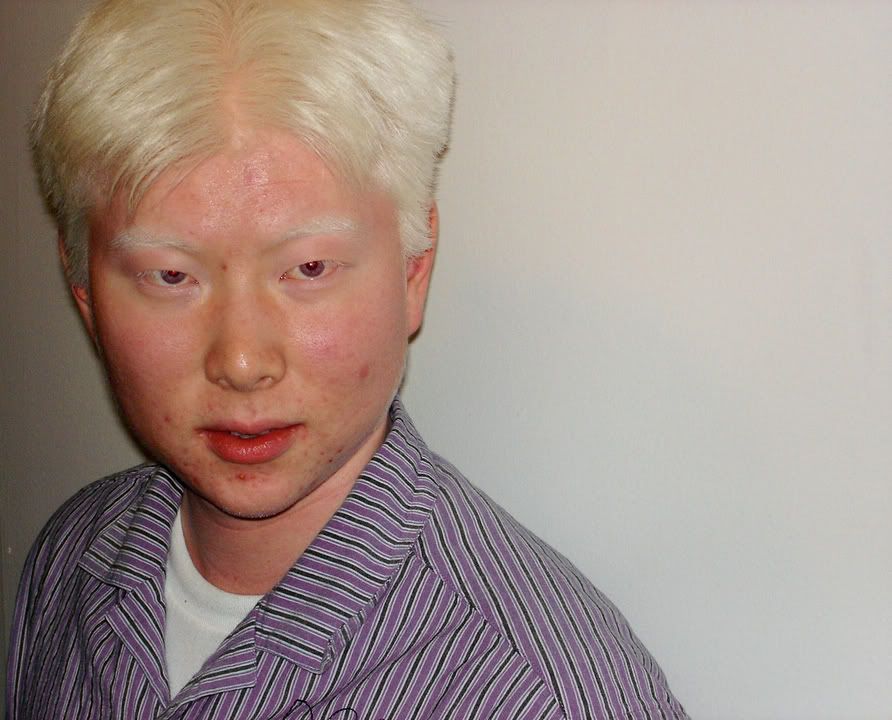 Albino.jpg