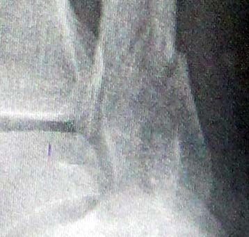 break_3-10-14-crop.jpg