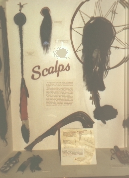 scalps.jpg