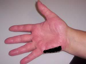 handdrillhand.jpg
