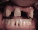 teeth.jpg