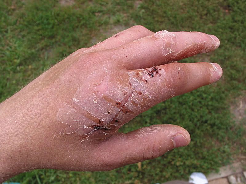 hand2.jpg