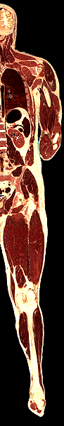 r2.gif