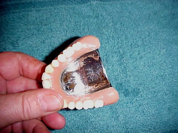 tooth.jpg