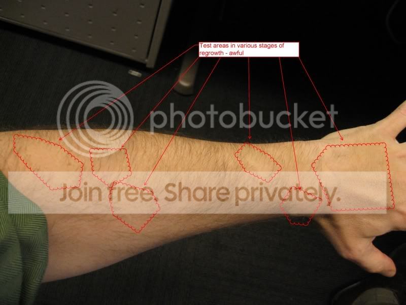 ForearmMange.jpg