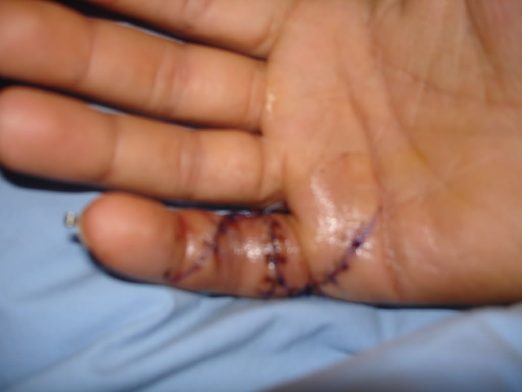 Finger.jpg