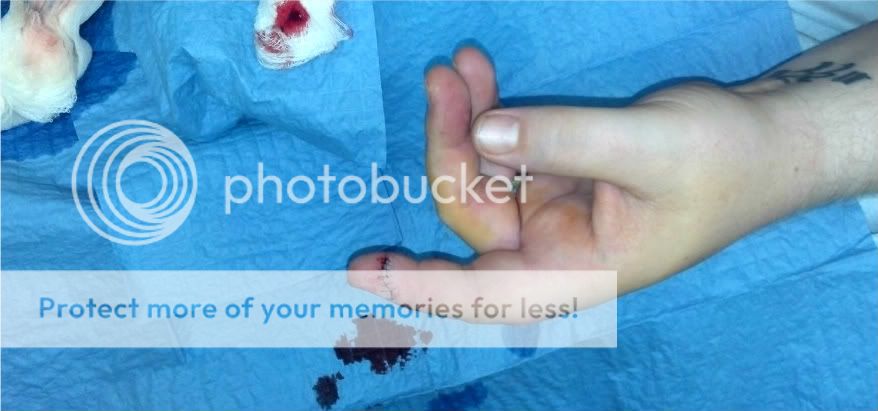2011-12-26_7stitches-1.jpg