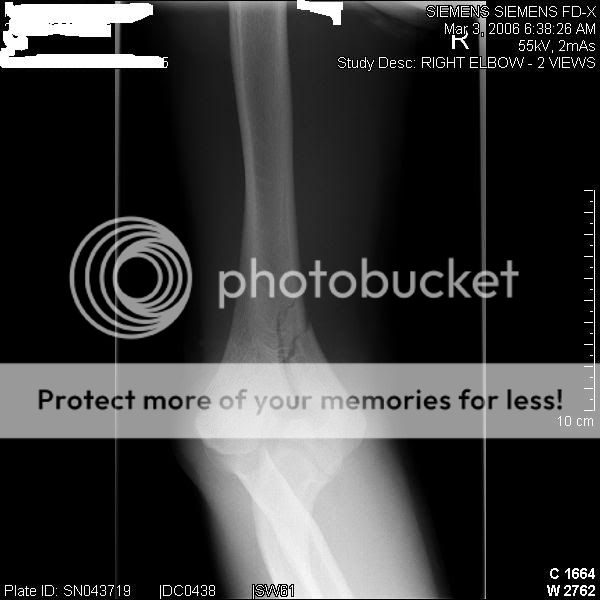 beforesurgery2.jpg