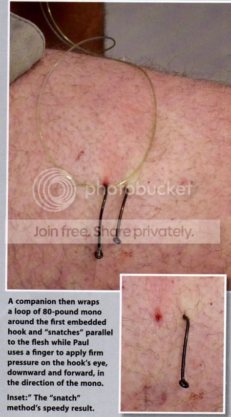Snatchmethod.jpg