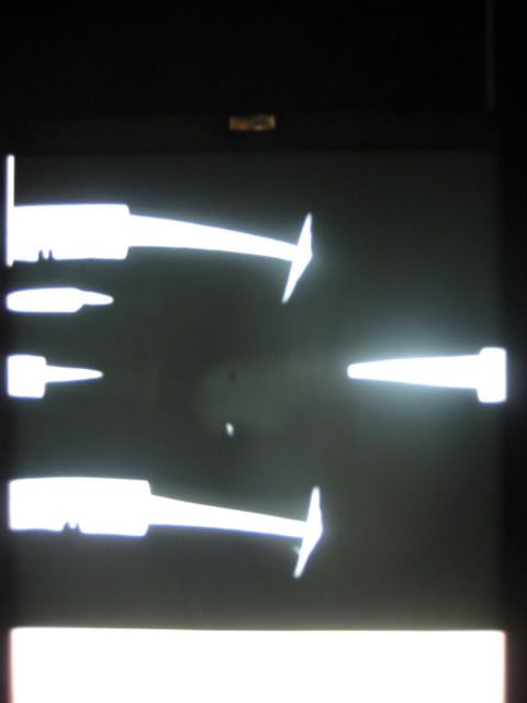khukX-ray001.jpg