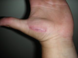 ouch004.jpg