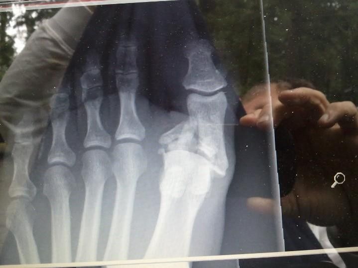 X-Ray_zpsfe1cedf7.jpg