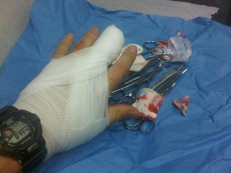 finger2.jpg