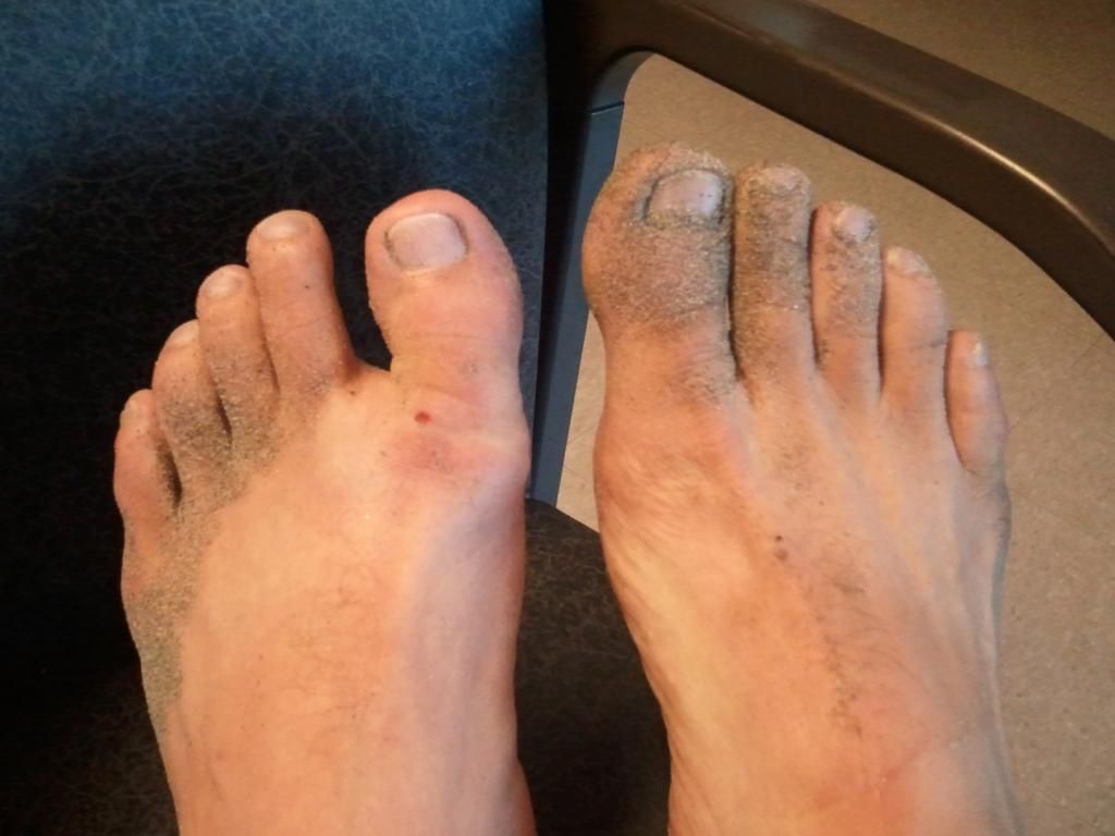 Toe1_zpsf7d4f77e.jpg