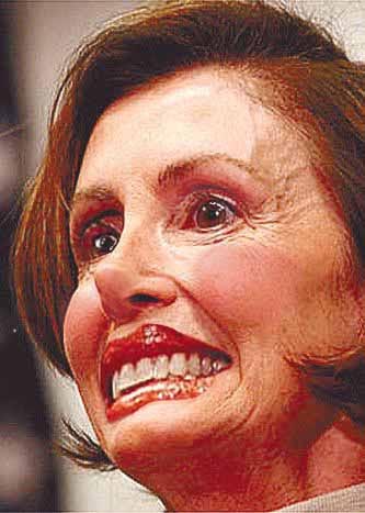 Nancy_Pelosi_Botox_Smile.jpg