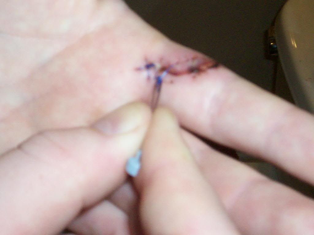Stitches006.jpg
