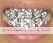 diamond_tooth_grill.jpg