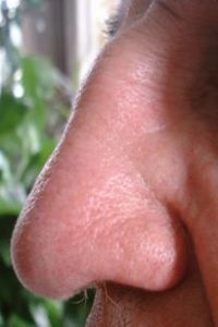 Nose1.jpg