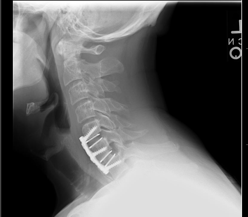 neck1.jpg