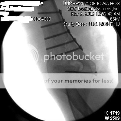 aftersurgery2.jpg