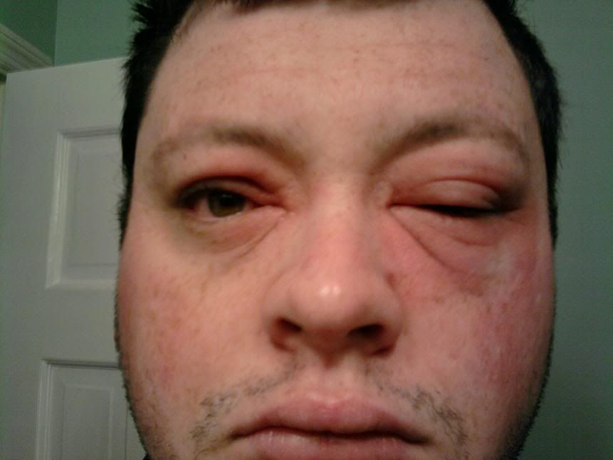 MyEyeInJasper.jpg